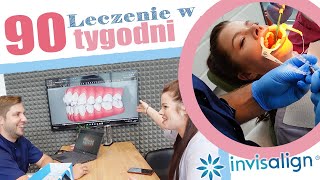 Niewidoczny aparat CZY TO BOLI Jak wygląda założenie aparatu ortodontycznego invisalign [upl. by Maisey]