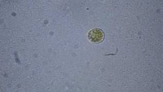 Dinoflagellate Swims the Salt Pond [upl. by Normandy]