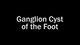 Ganglion Cyst of the Foot [upl. by Dewain56]