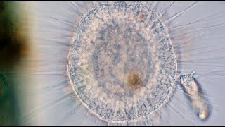 Rotifer Tangled Up with a Heliozoan [upl. by Shotton700]