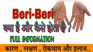 बेरी बेरी क्या है और कैसे होता है। BeriBeri thiamine deficiency।wet beriberi Vs dry beriberi [upl. by Weasner]