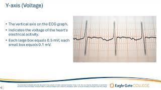 The ECG Graph [upl. by Rico]