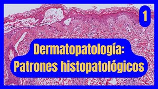 Patrones Histopatológicos en Dermatopatología Parte 1 [upl. by Elrebma]