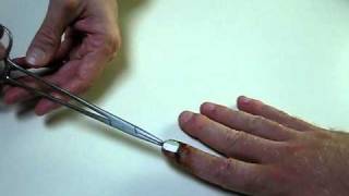 Kent Trivette getting metal pin pulled out of finger [upl. by Lebatsirc988]