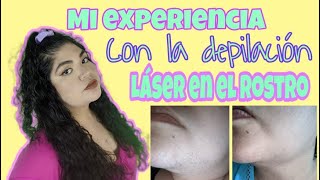 Mi experiencia con la depilación laser en el rostro  Rosycurvy [upl. by Esinehs138]