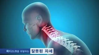 자생한방병원이 알려주는 목디스크 원인·증상·치료법 [upl. by Seigler]