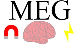 Magnetoencephalography measuring brain activity with magnetism [upl. by Anialad]