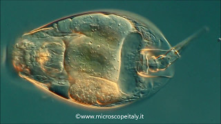 Rotifer rotifero lepadella [upl. by Silvana]