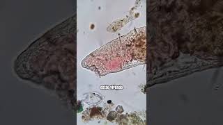 Um universo em uma gota dágua microorganismos microbiologia universo [upl. by Redd]