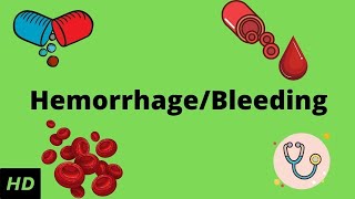 Hemorrhage bleeding Causes Signs and Symptoms Diagnosis and Treatment [upl. by Orwin]