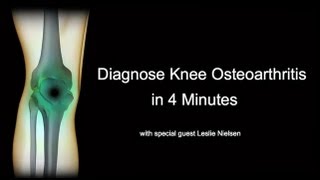 Diagnose Knee Osteoarthritis in 4 Minutes with Leslie Nielsen [upl. by Nudd]