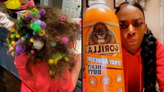 These Unusual Mishaps Almost Cost People Their Hair [upl. by Fredi]