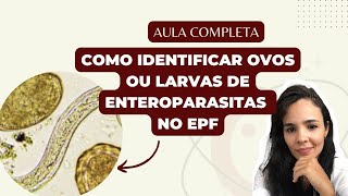 COMO IDENTIFICAR OVOS E LARVAS DE HELMINTOS NO EXAME PARASITOLÓGICO DE FEZES  AULA COMPLETA [upl. by Yasnyl]