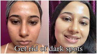 Best Dermatologist recommended Skincare Routine to remove Dark Spots Hyperpigmentation Acne Marks [upl. by Shelba]