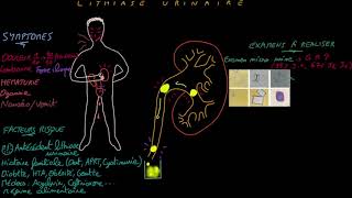 Lithiase urinaire  Docteur Synapse [upl. by Almeeta390]