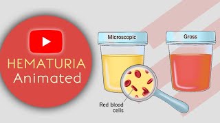 Hematuria  Blood in Urine in Easy  Animated [upl. by Rotciv29]