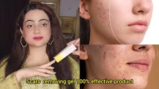 Acne scars removal Gel  contractubex Gel beauty facts acnescars scars pimples [upl. by Derward]