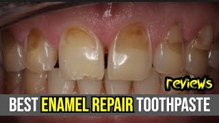 🦷 Best Enamel Repair Toothpaste Review 2024 Sensodyne Crest amp ARM amp Hammer 🌟 [upl. by Ezarras]