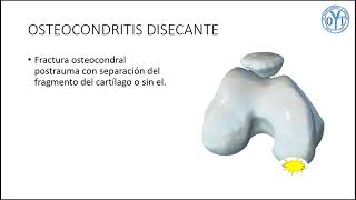 OSTEOCONDRITIS DISECANTE [upl. by Daveda]