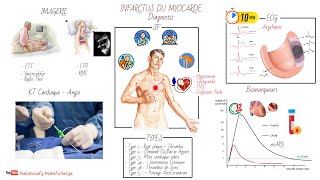 INFARCTUS DU MYOCARDE IDM  PHYSIOPATHOLOGIE ET DIAGNOSTIC [upl. by Noiro]