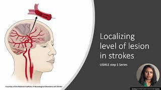 Stroke Localization Made Easy with Mnemonics Memorable Neurology Lecture 14 [upl. by Lehcim]