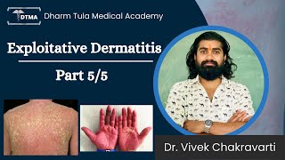 Dermatitis  Exfoliative Dermatitis Hindi  Types  Part 55 Eczema  Skin Disease  Skin Infection [upl. by Neras]