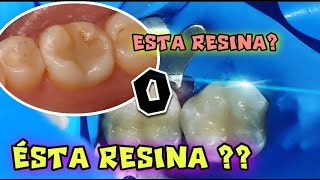 CUAL RESINA O EMPASTE de COMPOSITE ES MEJOR [upl. by Attennaj767]