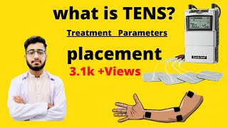 TENS transcutaneous electrical nerve stimulation comfy stim Use  parameters  placement [upl. by Harrad297]