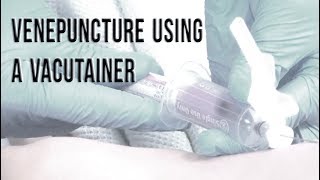 Venepuncture Using a Vacutainer [upl. by Kcid]