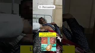 Complete Abdominal Examination Techniques and Findings shorts ytshorts medical [upl. by Nnahgem]