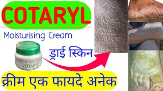 COTARYL Skin Cream Uses  What is Hyperkeratotic skin and Ichthyosis skin and its tretments [upl. by Anib869]