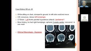 Diagnosing strokes with imaging CT MRI and Angiography  NCLEXRN  Khan Academy [upl. by Eibbob]