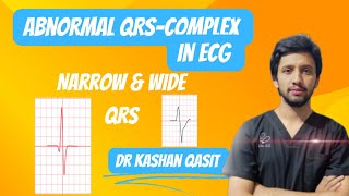 Abnormal QRS Complex In ECG QRS ComplexNarrow amp Wide QRS ECGEKGDr Kashan Qasit [upl. by Rehptosirhc]