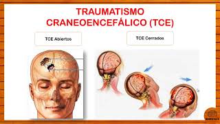 ETIOLOGÍA DEL DAÑO CEREBRAL EXPLICADO SUPER FÁCIL Y COMPLETO [upl. by Anjanette]