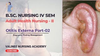 Otitis Externa Part2  Diagnosis Finding Management  Valinee Nursing Academy [upl. by Ecnahc]