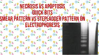 DIFFERENCE BETWEEN NECROSIS AND APOPTOSISWhat is Necrosis Vs What is Apoptosis [upl. by Nolly]