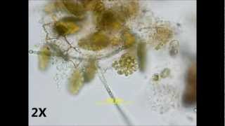 Pediastrum duplex  autocolony formation [upl. by Ettenyar44]