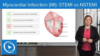 Myocardial Infarction MI STEMI vs NSTEMI – MedSurg Nursing  Lecturio Nursing [upl. by Eeluj432]