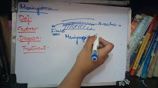 MENINGIOMA in relation to orbit made simple [upl. by Glyn]