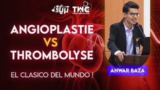 CARDIOLOGIE  Angioplastie VS Thrombolyse  Anwar Baza [upl. by Aikemal791]