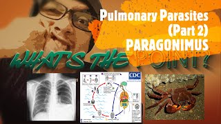 PULMONARY PARASITES Part 2 of 3  PARAGONIMUS [upl. by Eerehs]