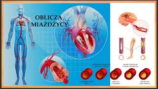 07 ZDROWIE METABOLICZNE  Okiem Praktyka i Dietetyka 20240814 zaburzenia krążenia [upl. by Idnew]