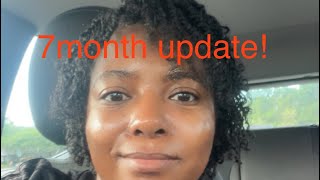 Ethnic Rhinoplasty 7 month update [upl. by Japeth625]