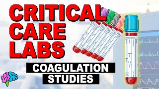 Coags  Coagulation Studies  Critical Care Labs [upl. by Tnayrb96]