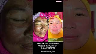 DRW SKINCARE PAKET RADIANT BRIGHTENING skincareroutine [upl. by Weissmann]