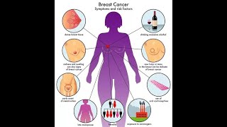 benign tumors of breast [upl. by Zehe327]