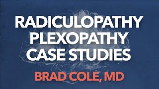 Radiculopathy Plexopathy case studies 1 [upl. by Yule]