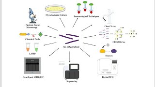 Investigation and Prognosis of Tuberculosis [upl. by Dimphia]