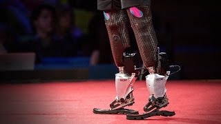 New bionics let us run climb and dance  Hugh Herr  TED [upl. by Cohl579]