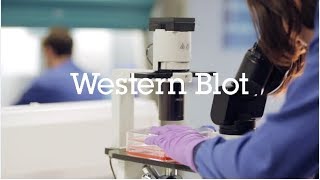 Western blot protocol video [upl. by Ahsineb948]